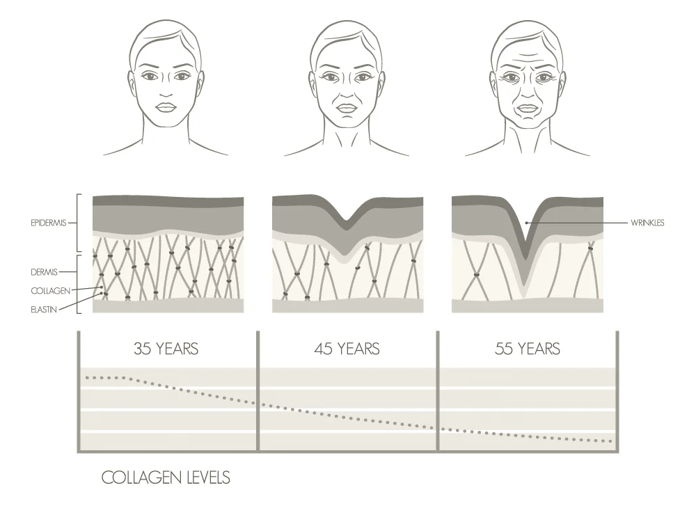 Astria Medical Aesthetics: Causes of Fine Lines and Wrinkles