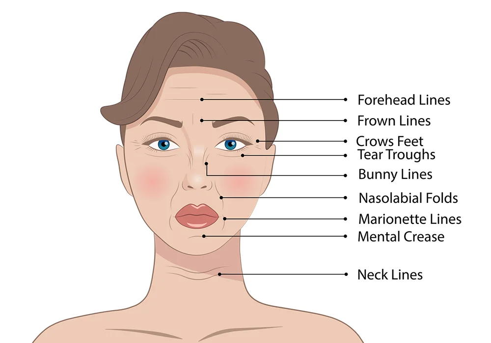 Astria Medical Aesthetics: Common areas of Sagging and Fine Lines