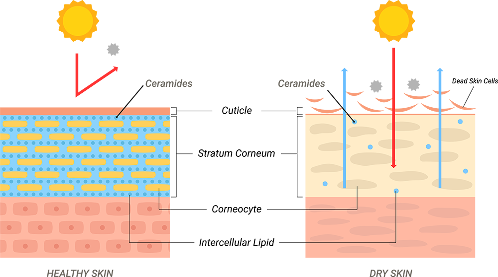 Astria Medical Aesthetics: Why Dry Skin occurs