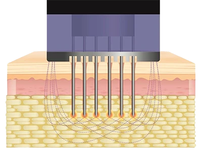 Astria Medical Aesthetics: Hair Loss protection
