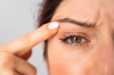Astria Medical Aesthetics: Why Eye Laxity