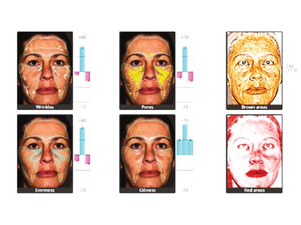 ASTRIA-MEDICAL-AESTHETICS-LifeViz-full-facial-analysis-02