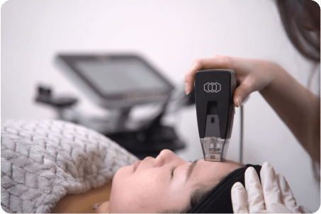 How many Morpheus8 RF Microneedling sessions do i need?