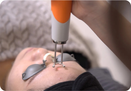 PicoLaser_CloseUp.jpg