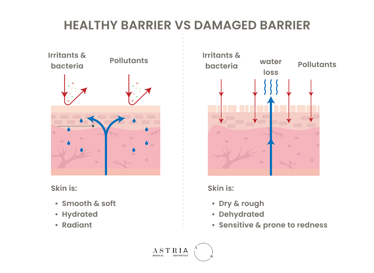 A dehydrated skin barrier is weaker