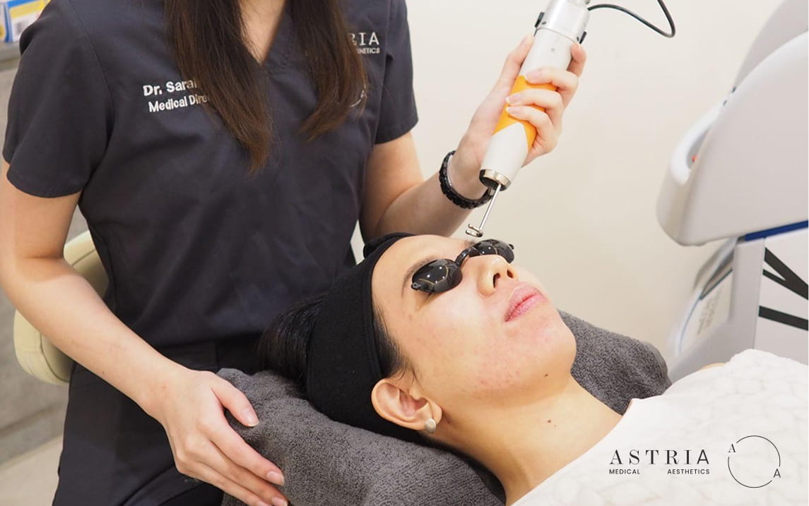 Better-Planned Pico Laser Sessions
