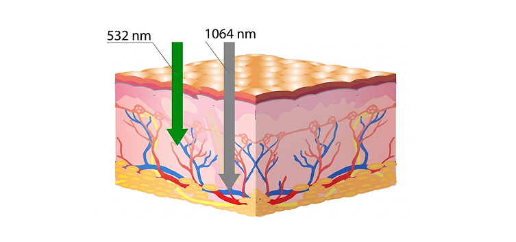 Different Wavelengths Target Different Pigmentation