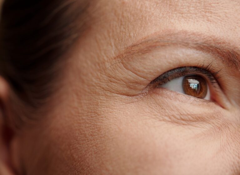 Wrinkles And Fine Lines