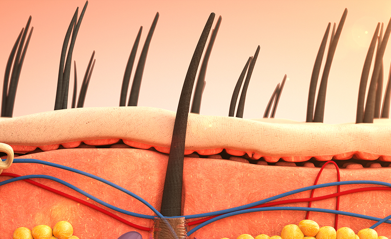 Pico vs. PicoSure in Singapore