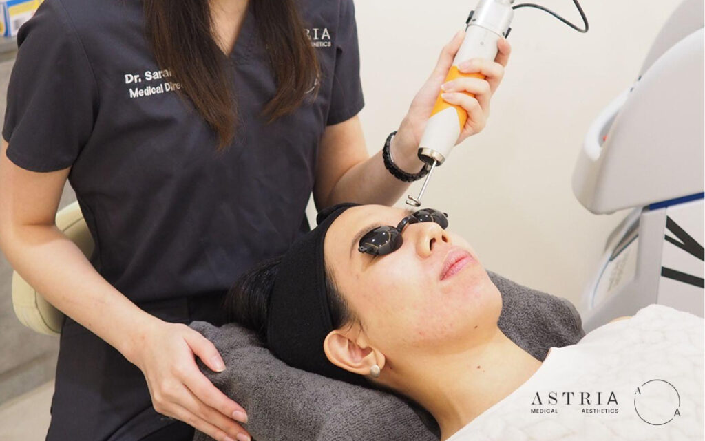 Best Aesthetic Clinic for Pico Laser in Singapore