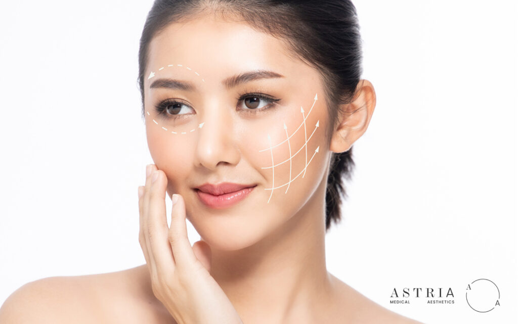 Benefit of HIFU Beyond Lifting