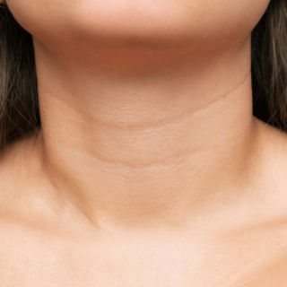 p-neck-line-occur